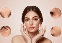 botox injections